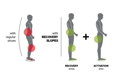 Steunzolen of inlegzolen