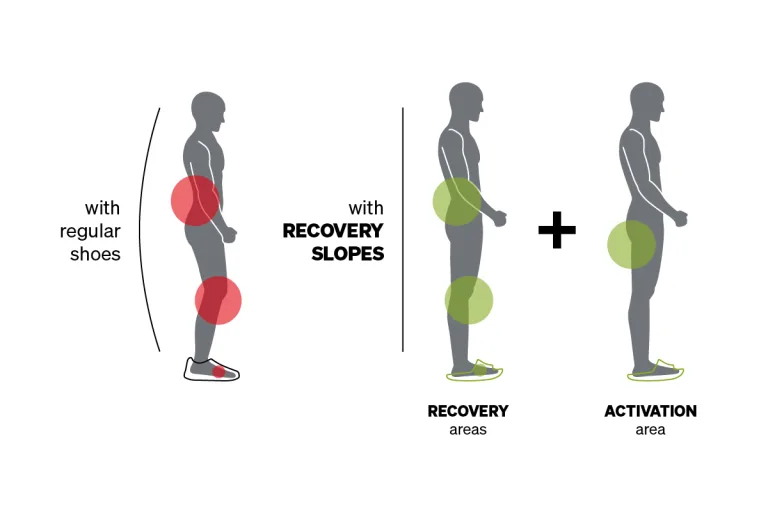 Steunzolen of inlegzolen