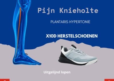 Pijn knieholten en onderbeen